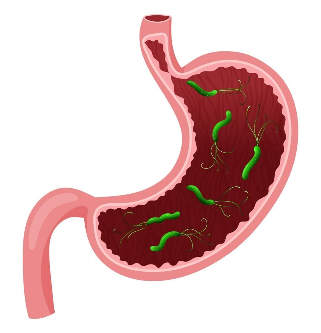 Helicobacter pylori tedavisi gördünüz ama bakteri tekrar mı etti? Antibiyotik direnci artıyor, standart tedavi her zaman yetmiyor. Mekanizma, neden kronikleştiği ve mide ortamını destekleyen bütüncül yaklaşım bu yazıda.